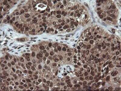 Immunohistochemistry: Von Hippel Lindau Antibody (OTI1E1) - Azide and BSA Free [NBP2-74851]