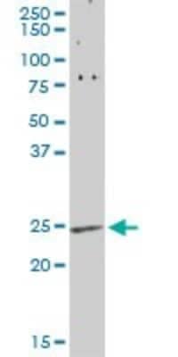 Western Blot: Von Hippel Lindau Antibody [H00007428-D01P]