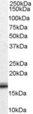 Western Blot: Von Hippel Lindau Antibody [NB100-41384]