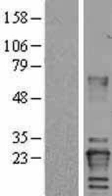 Western Blot: Von Hippel Lindau Overexpression Lysate [NBL1-17719]