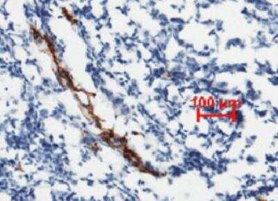 Immunohistochemistry-Paraffin: Von Willebrand Factor Antibody (111) [NBP2-89724]