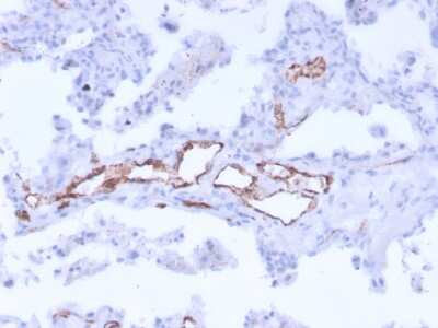 Immunohistochemistry-Paraffin: Von Willebrand Factor Antibody (3E2D10 + VWF635) [NBP2-34310]