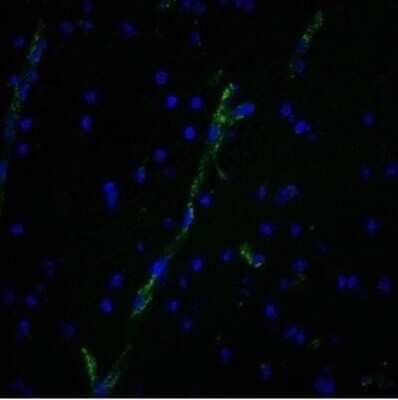 Immunohistochemistry-Paraffin: Von Willebrand Factor Antibody (3E2D10) - Azide and BSA Free [NBP2-34535]