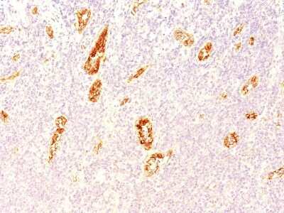 Immunohistochemistry-Paraffin: Von Willebrand Factor Antibody (3E2D10) [NBP2-33002]