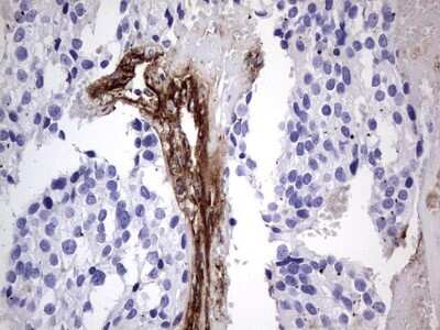 Immunohistochemistry: Von Willebrand Factor Antibody (OTI6C7) [NBP2-46358]