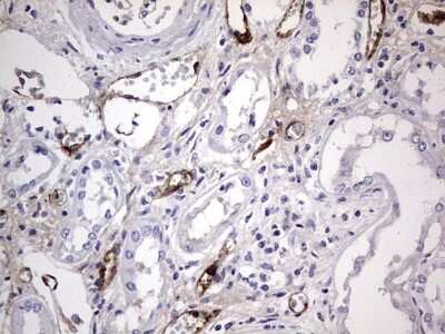 Immunohistochemistry: Von Willebrand Factor Antibody (OTI6C7) [NBP2-46358]