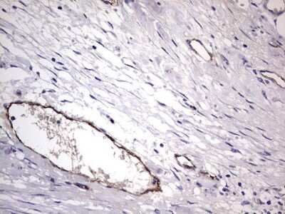 Immunohistochemistry: Von Willebrand Factor Antibody (OTI6C7) [NBP2-46358]