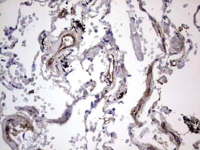 Immunohistochemistry: Von Willebrand Factor Antibody (OTI6C7) [NBP2-46358]