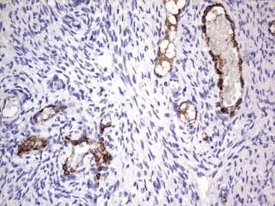 Immunohistochemistry: Von Willebrand Factor Antibody (OTI6C7) [NBP2-46358]