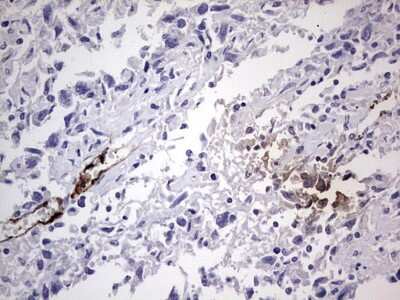 Immunohistochemistry: Von Willebrand Factor Antibody (OTI6C7) [NBP2-46358]