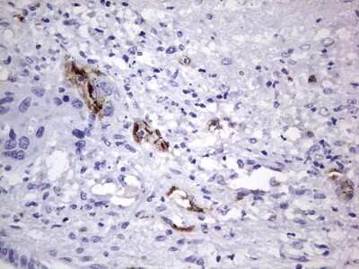 Immunohistochemistry: Von Willebrand Factor Antibody (OTI6C7) [NBP2-46358]