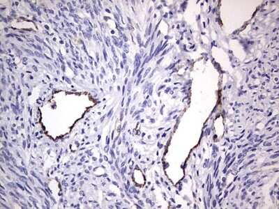 Immunohistochemistry: Von Willebrand Factor Antibody (OTI6C7) [NBP2-46358]