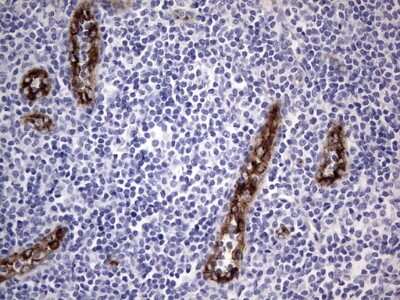 Immunohistochemistry: Von Willebrand Factor Antibody (OTI6C7) [NBP2-46358]