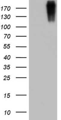 Western Blot: Von Willebrand Factor Antibody (OTI6C7) [NBP2-46358]