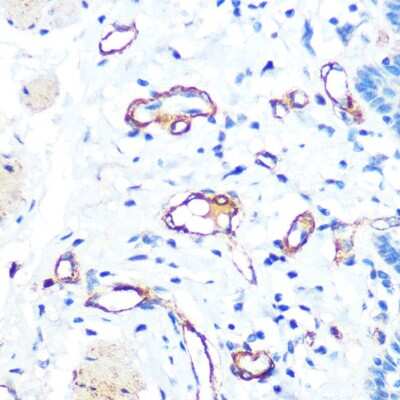 Immunohistochemistry-Paraffin: Von Willebrand Factor Antibody (8O6D7) [NBP3-15465]