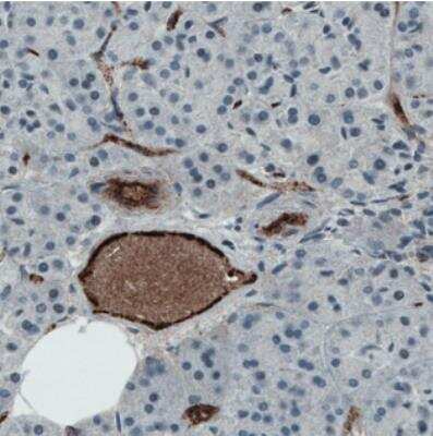 Immunohistochemistry-Paraffin: Von Willebrand Factor Antibody (CL1950) [NBP2-34474]