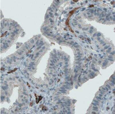 Immunohistochemistry-Paraffin: Von Willebrand Factor Antibody (CL1950) [NBP2-34474]