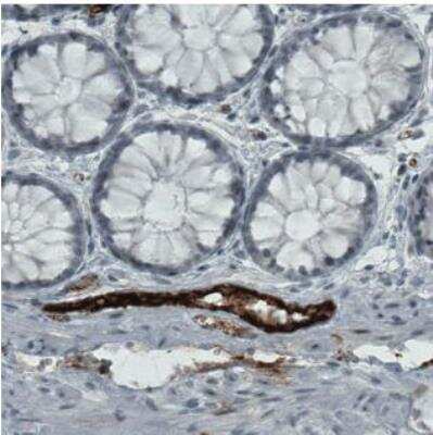 Immunohistochemistry-Paraffin: Von Willebrand Factor Antibody (CL1957) [NBP2-34494]
