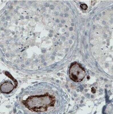 Immunohistochemistry-Paraffin: Von Willebrand Factor Antibody (CL1957) [NBP2-34494]