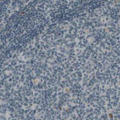 Immunohistochemistry-Paraffin: Von Willebrand Factor Antibody (CL1957) [NBP2-34494]