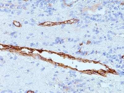 Immunohistochemistry-Paraffin: Von Willebrand Factor Antibody (IIIE2.34) [NBP2-44995]