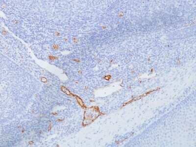 Immunohistochemistry-Paraffin: Von Willebrand Factor Antibody (IIIE2.34) [NBP2-44995]