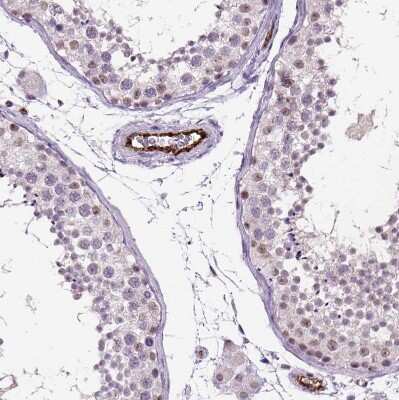 Immunohistochemistry-Paraffin: Von Willebrand Factor Antibody [NBP1-84761]