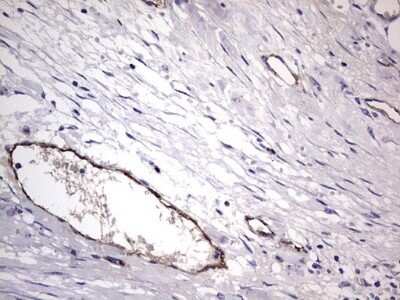 Immunohistochemistry: Von Willebrand Factor Antibody (OTI6C7) - Azide and BSA Free [NBP2-74852]