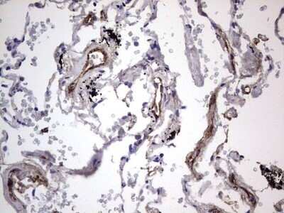 Immunohistochemistry: Von Willebrand Factor Antibody (OTI6C7) - Azide and BSA Free [NBP2-74852]
