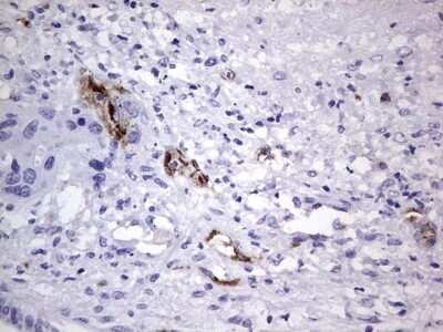 Immunohistochemistry: Von Willebrand Factor Antibody (OTI6C7) - Azide and BSA Free [NBP2-74852]