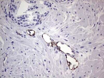 Immunohistochemistry: Von Willebrand Factor Antibody (OTI6C7) - Azide and BSA Free [NBP2-74852]