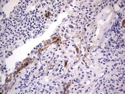 Immunohistochemistry: Von Willebrand Factor Antibody (OTI6C7) - Azide and BSA Free [NBP2-74852]