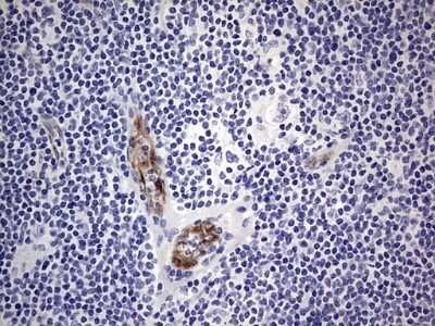 Immunohistochemistry: Von Willebrand Factor Antibody (OTI6C7) - Azide and BSA Free [NBP2-74852]