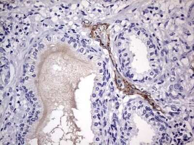 Immunohistochemistry: Von Willebrand Factor Antibody (OTI6C7) - Azide and BSA Free [NBP2-74852]