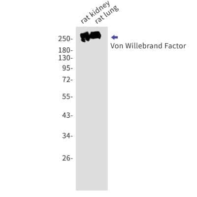 Western Blot: Von Willebrand Factor Antibody (S01-5D2) [NBP3-14887]