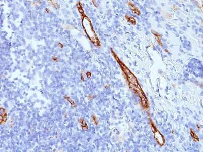 Immunohistochemistry-Paraffin: Von Willebrand Factor Antibody (SPM577) [NBP2-33004]