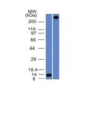 Western Blot: Von Willebrand Factor Antibody (VWF/1465) [NBP2-53314]