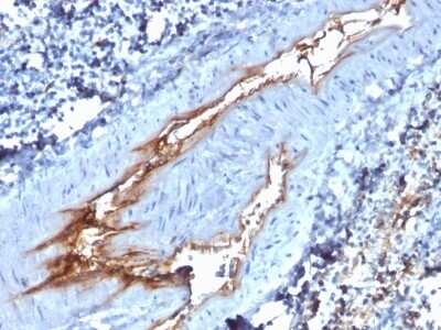 Immunohistochemistry-Paraffin: Von Willebrand Factor Antibody (VWF/1767) - Azide and BSA Free [NBP2-54497]