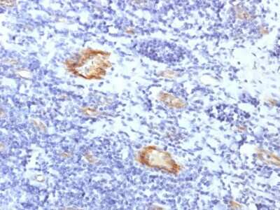 Immunohistochemistry-Paraffin: Von Willebrand Factor Antibody (VWF/1859R) [NBP3-07217]