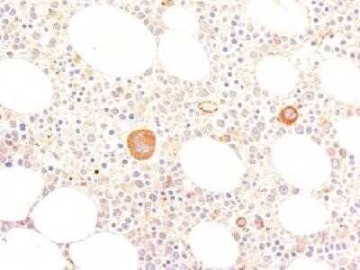 Immunohistochemistry-Paraffin: Von Willebrand Factor Antibody (VWF635) - Azide and BSA Free [NBP2-34510]