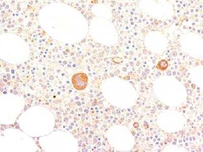Immunohistochemistry-Paraffin: Von Willebrand Factor Antibody (VWF635) [NBP2-33003]