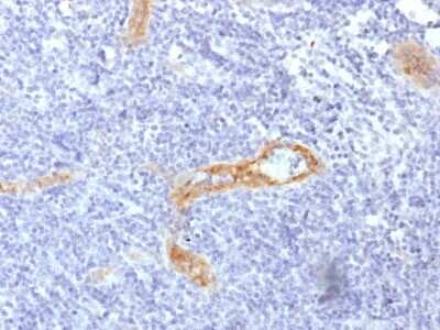 Immunohistochemistry-Paraffin: Von Willebrand Factor Antibody (rVWF/1465) [NBP3-07216]