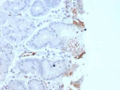 Immunohistochemistry-Paraffin: Von Willebrand Factor Antibody (rVWF/2480) [NBP3-07200]