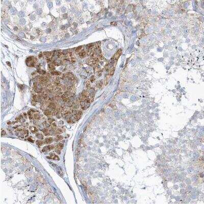 Immunohistochemistry-Paraffin: VprBP Antibody [NBP1-85284]