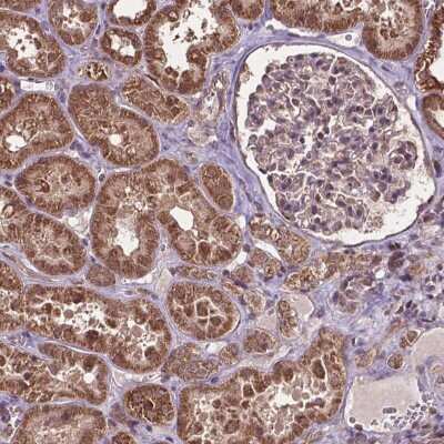 Immunohistochemistry-Paraffin: VprBP Antibody [NBP2-49073]