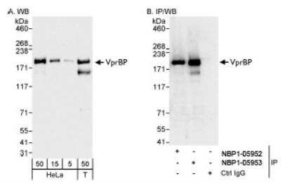 Western Blot: VprBP Antibody [NBP1-05953]