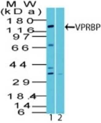 Western Blot: VprBP Antibody [NBP2-27203]