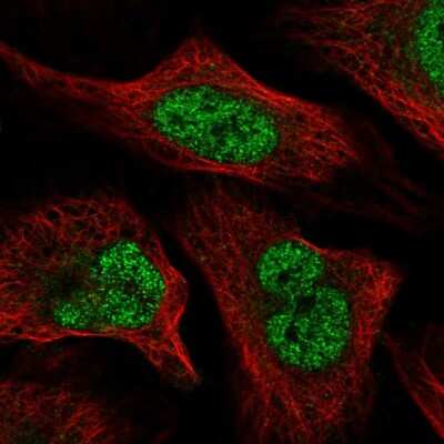 Immunocytochemistry/ Immunofluorescence: WAC Antibody [NBP2-59019]