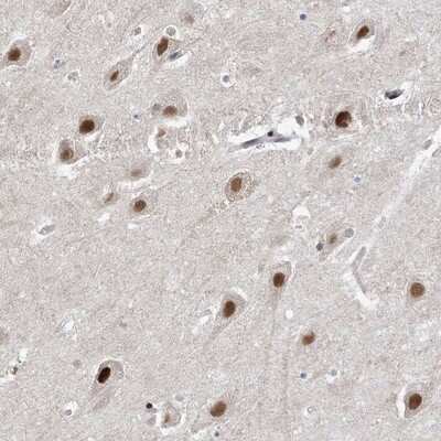 Immunohistochemistry-Paraffin: WAC Antibody [NBP1-88581]