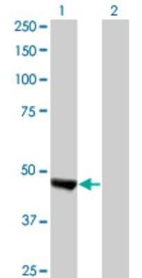 Western Blot: WAPL Antibody (2B3) [H00023063-M02]